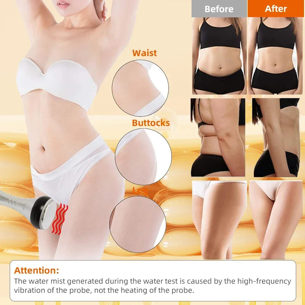 Missheart Ultrasonic Cavitation Body Slimming Machine With Vacuum Suction