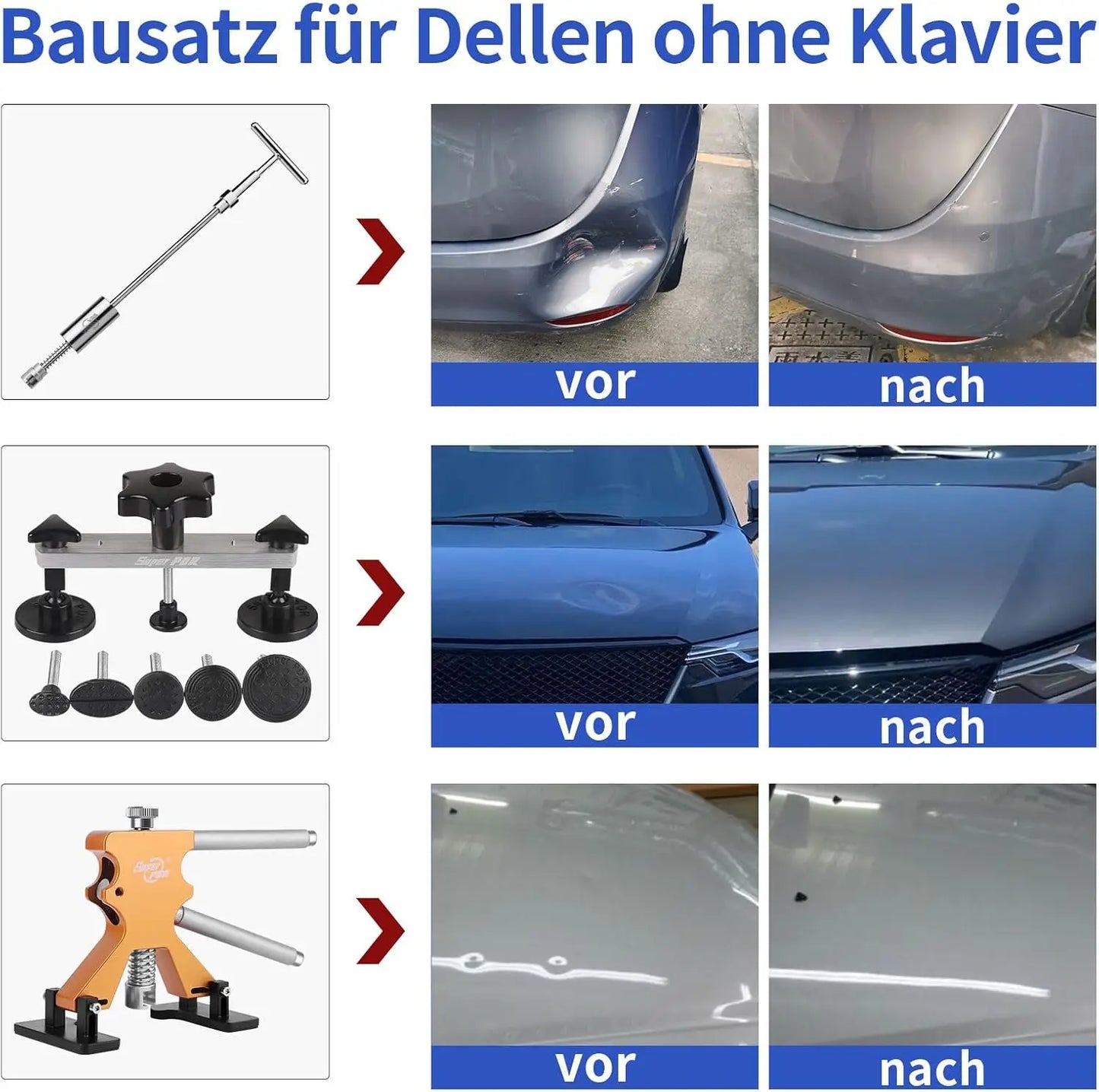 PDR Auto Paintless Body Dent Removal Kits Car Dent Repair Tools Automotive Dent Remover Suction Cup Dent Puller Tool Kit for Car