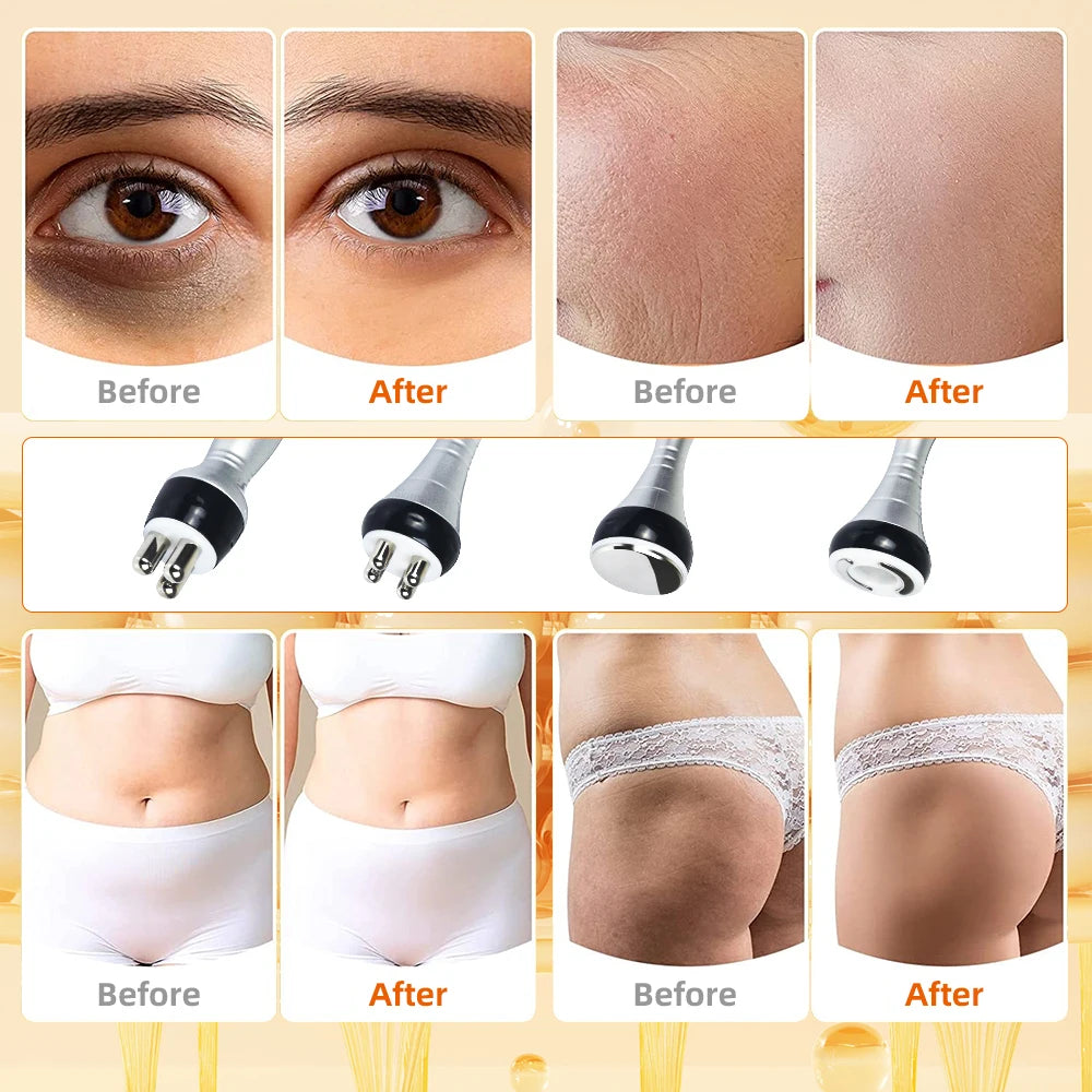 Missheart Ultrasonic Cavitation Body Slimming Machine With Vacuum Suction